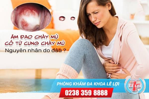 Âm đạo chảy mủ, cổ tử cung chảy mủ nguyên nhân do đâu, cách chữa thế nào?