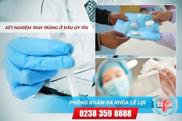 Xét nghiệm tinh trùng ở đâu uy tín