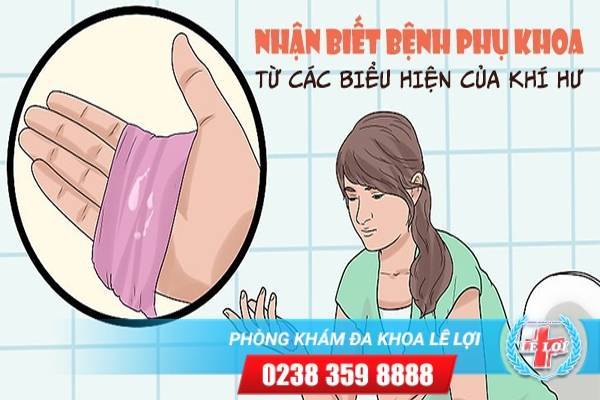 Nhận biết bệnh phụ khoa từ các biểu hiện bất thường ở khí hư nữ giới