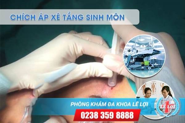 Phương pháp loại bỏ ap-xe tầng sinh môn - Liệu trình một lần duy nhất