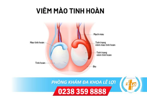 viem-mao-tinh-hoan (2)